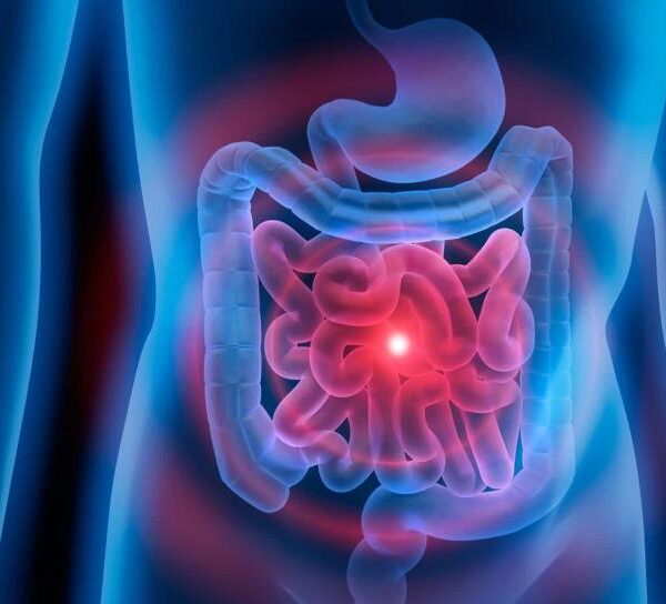 Candidiasis Intestinal y Parasitosis